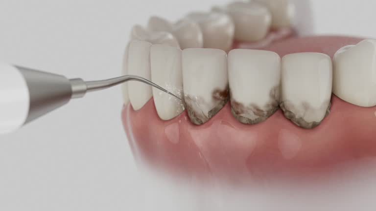 Reliable Dental Implants contractor in Clemmons, NC by Smile Center Dentistry